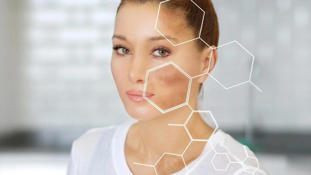Understanding Hyperpigmentation and the Role of Hydroquinone in Achieving a More Even Complexion 2 image 2